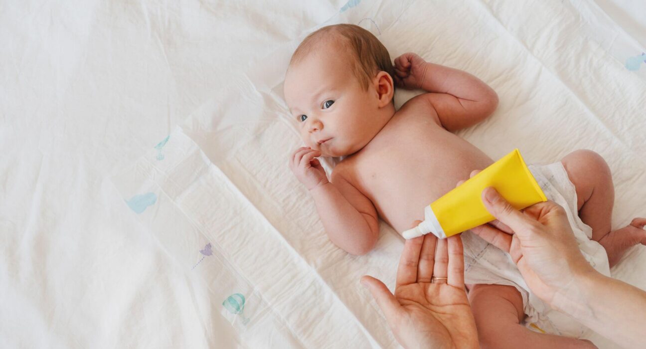 Elternteil versorgt Baby mit Creme